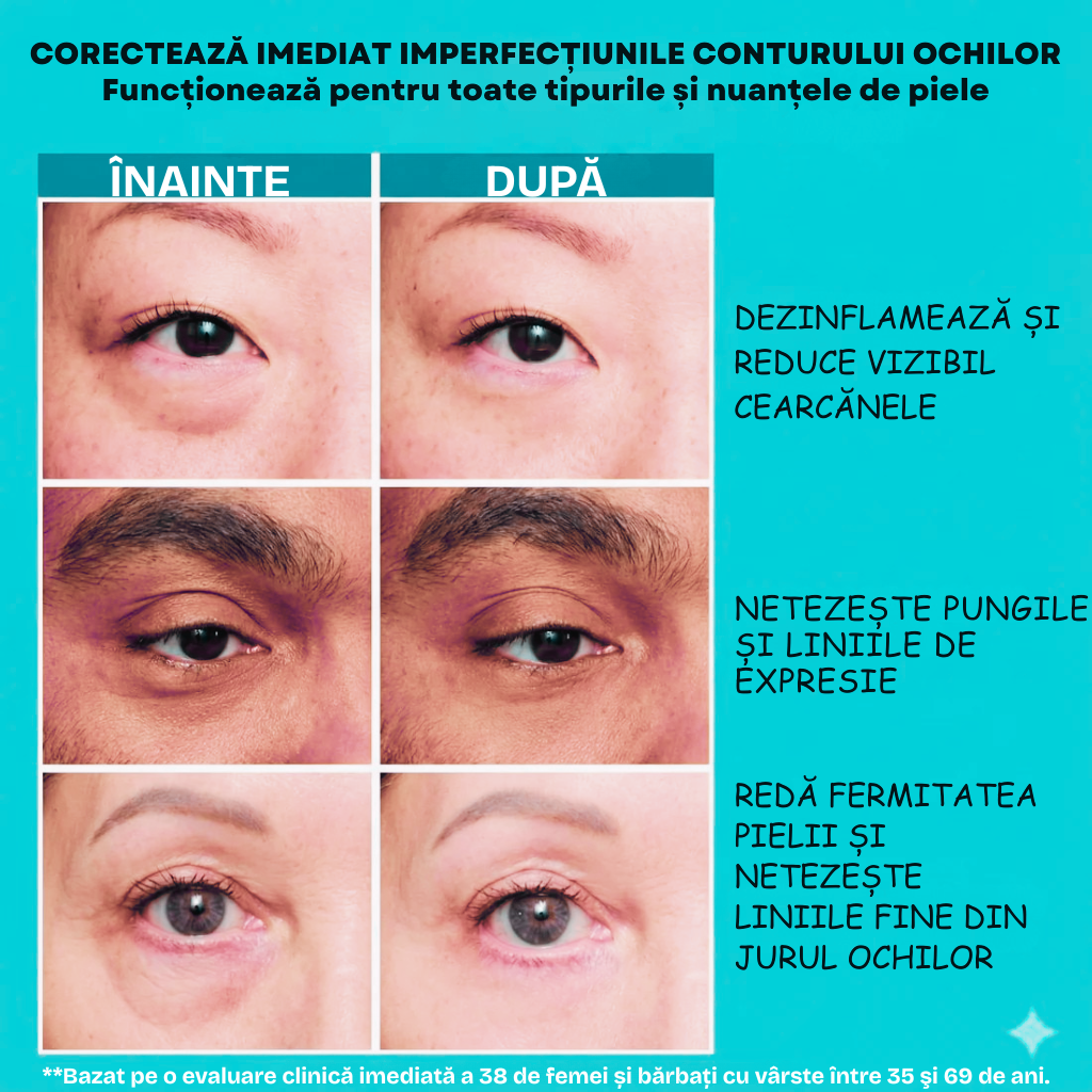 DermaFerm Cearcăne